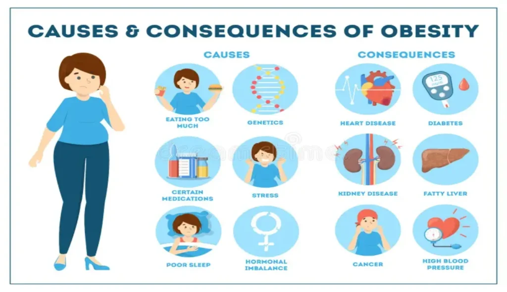 Causes of Obesity Explained