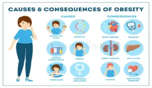 Causes of Obesity Explained
