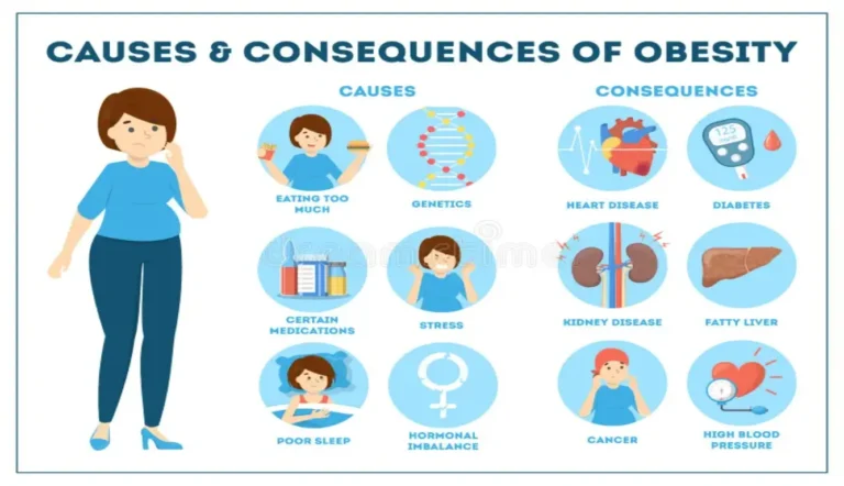 Causes of Obesity Explained