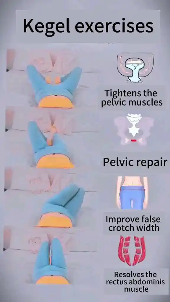 Kegel Exercises