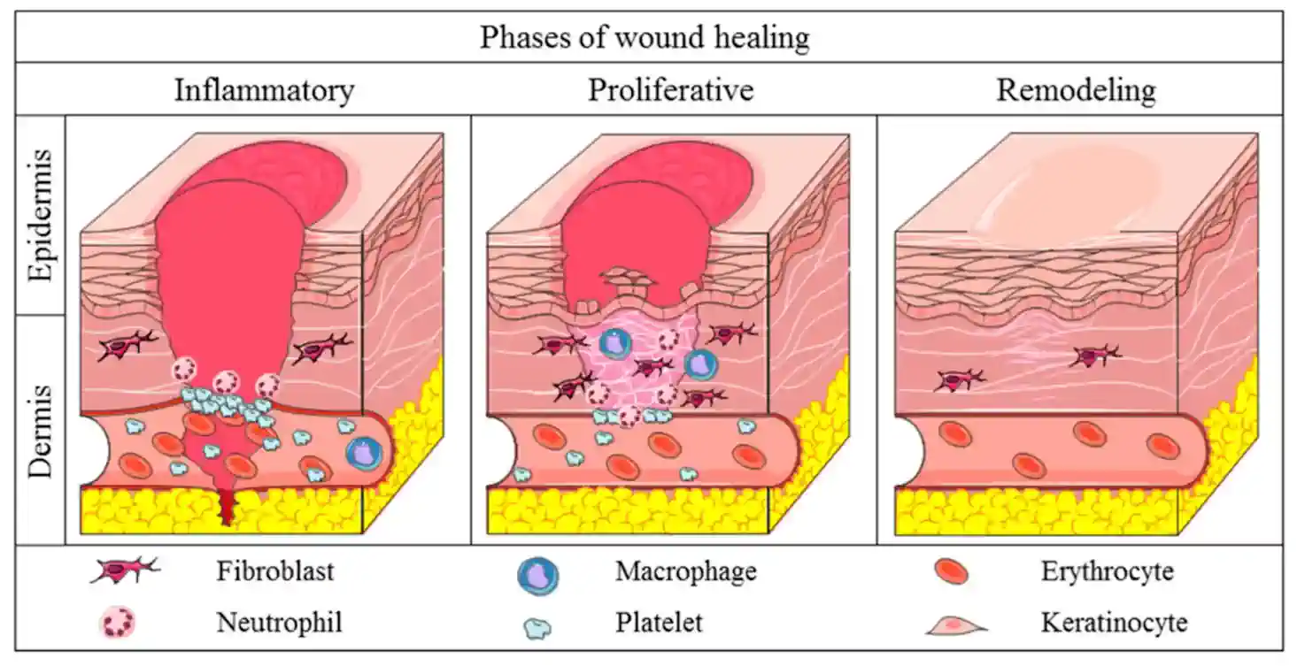 The body's healing process